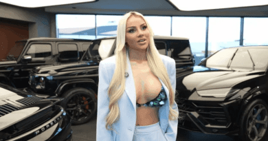 Banorja me dhëmbë 14 mijë euro zbulon pa dashje pjesë intime – VIDEO